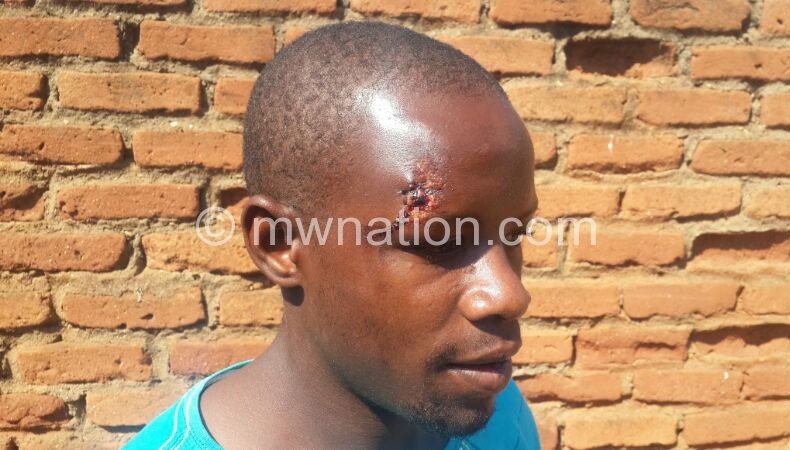 Was injured in the fracas: Footballer Tony Chitsulo 