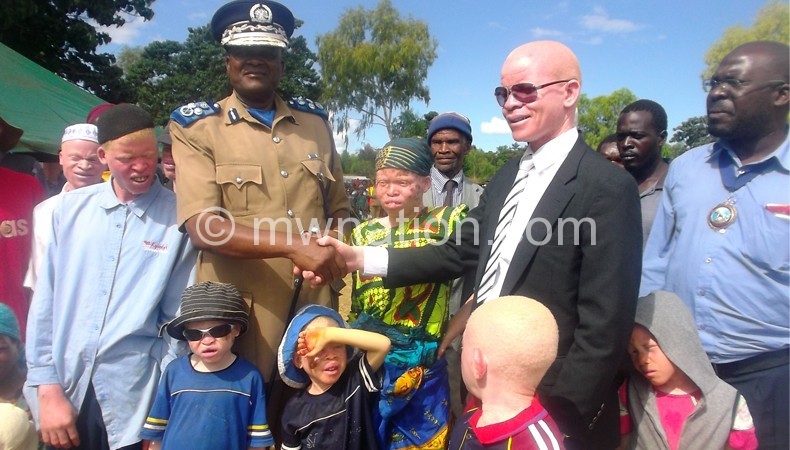 Kachama (L) with Massah and other people with albinism