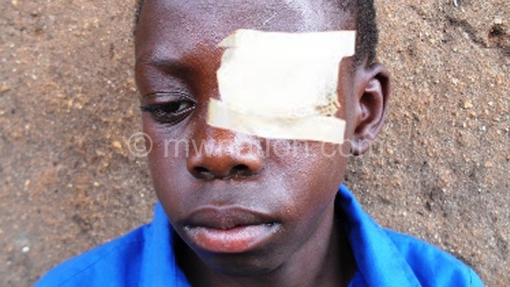 Precious with his bruised eye after treatment 