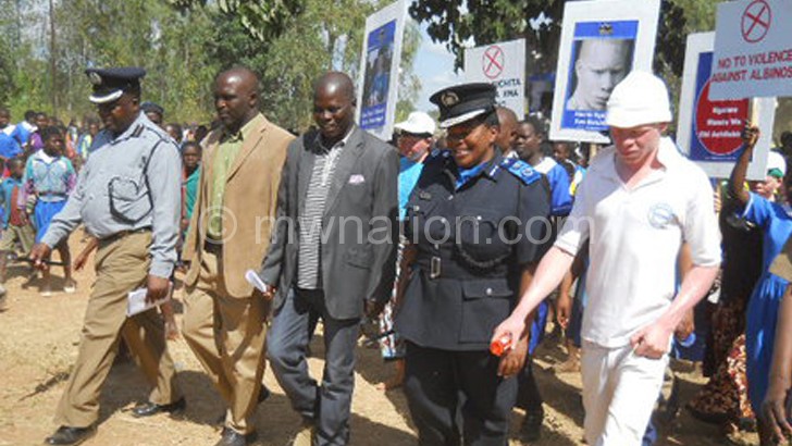 Police have joined the campaign against abductions and killings of albinos