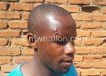 Was injured in the fracas: Footballer Tony Chitsulo
