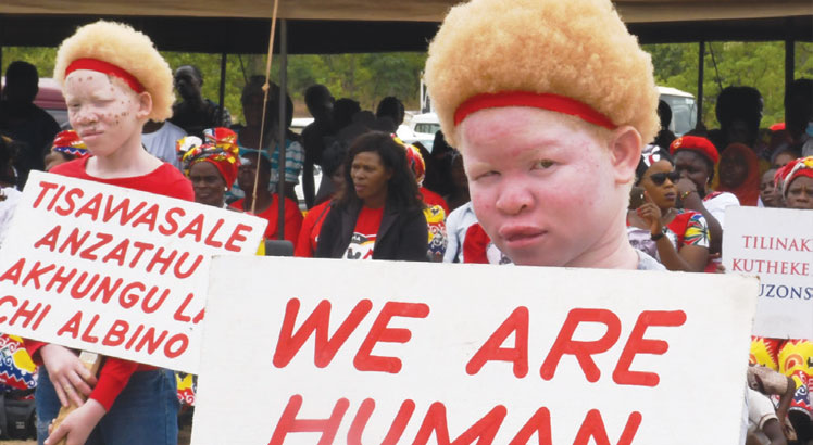 Protect people with albinism—Human rights body
