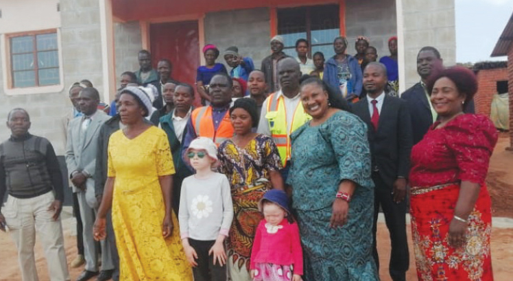 Govt constructs houses for people with albinism